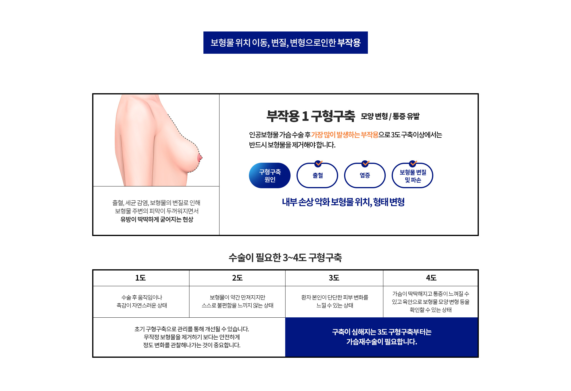 구형구축