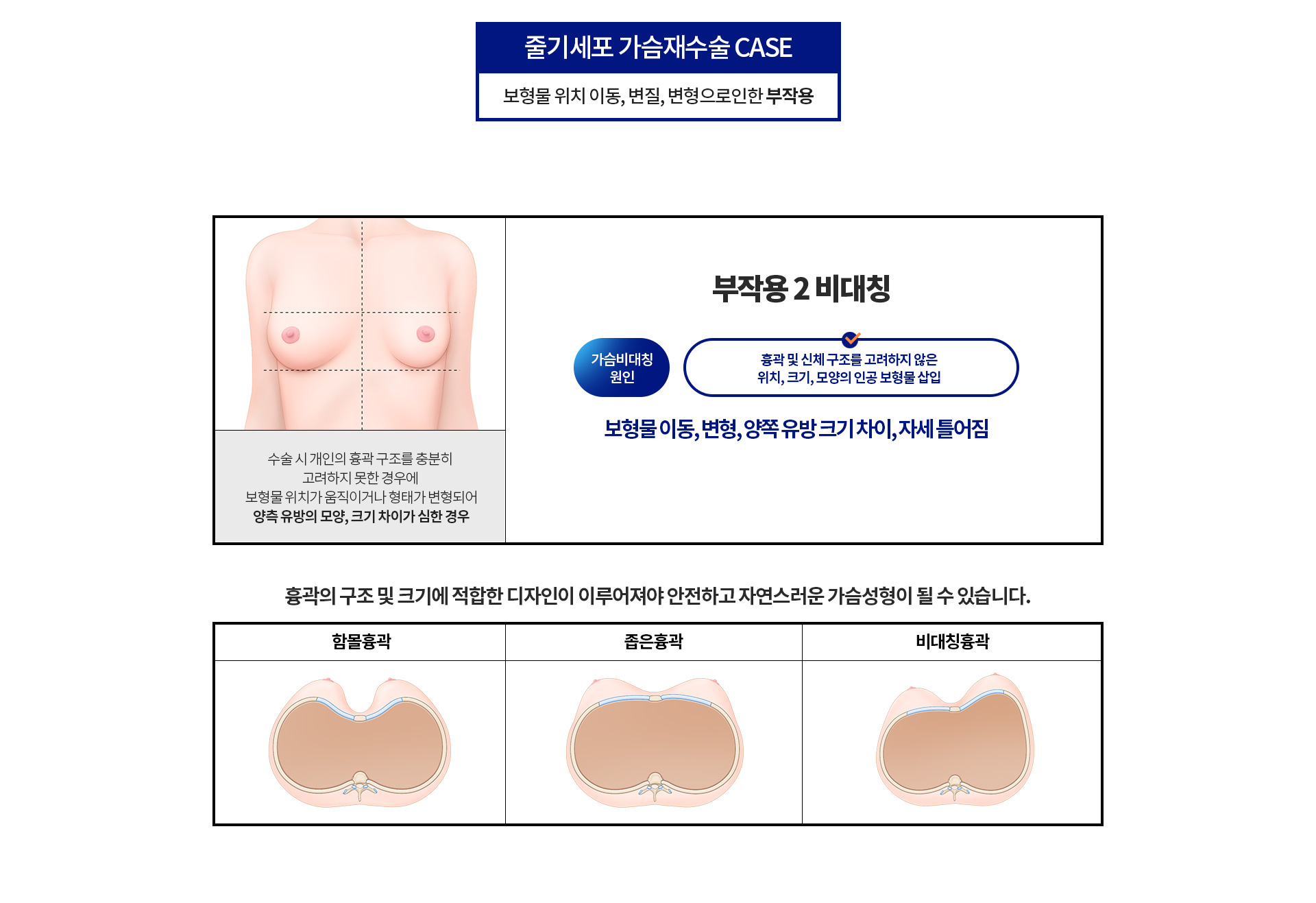 비대칭