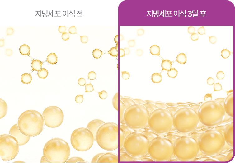sc301의원 svf 얼굴성형 차별화포인트 이미지