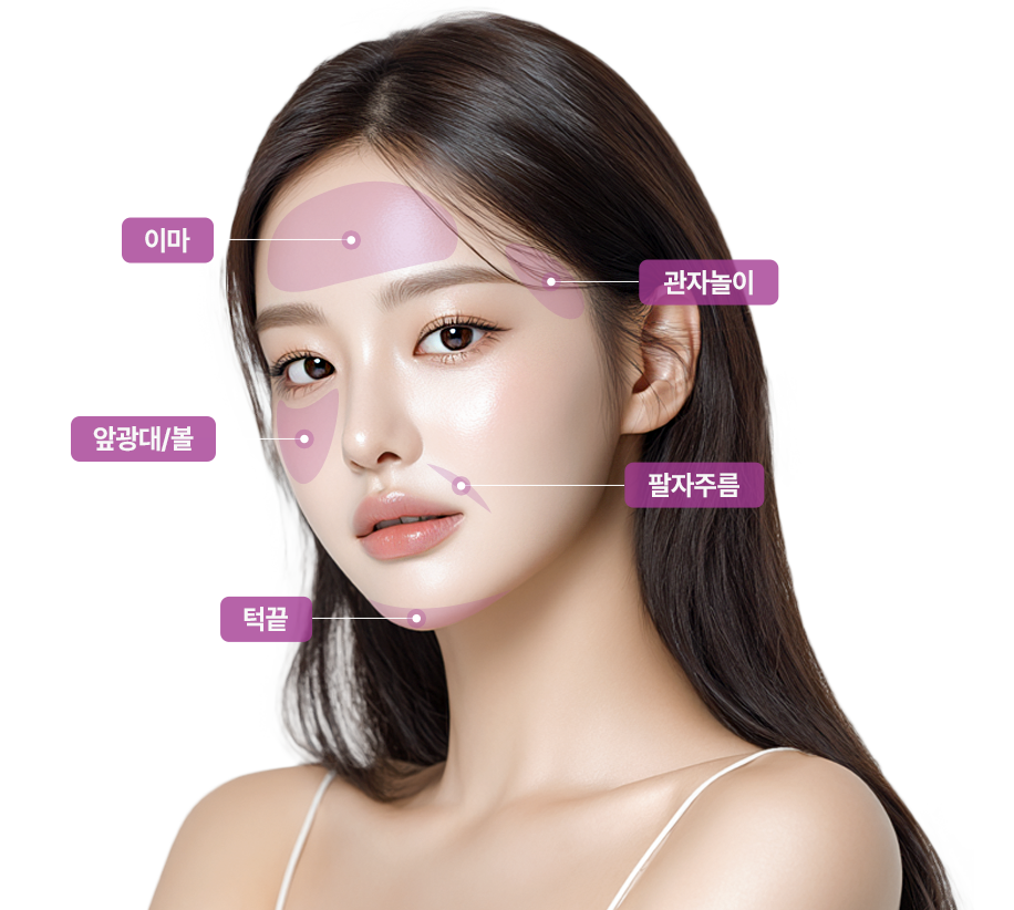 sc301의원 SVF 얼굴성형 수술부위 이미지