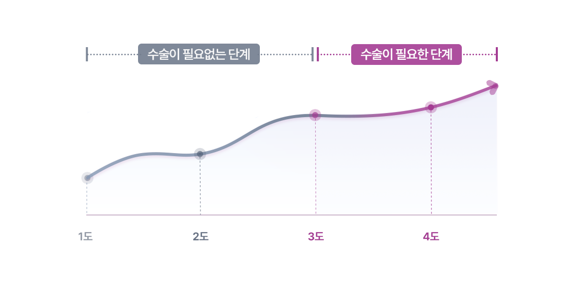 가슴 재수술 단계별 증상 그래프 이미지
