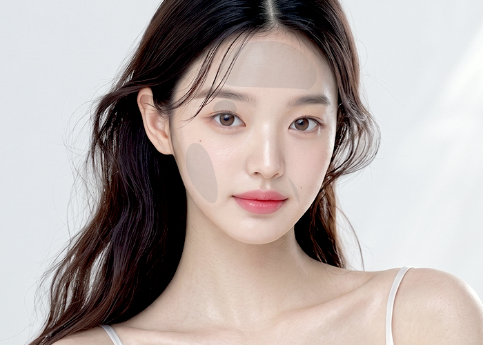 SVF 지방이식 적용 부위 세번째 이미지