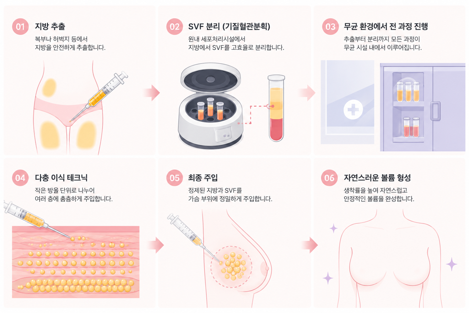 3d75de02-5d8c-4c6c-9611-b27729f974e3 가슴성형잘하는곳 탐색 시 확인해야 할 비배양 SVF 생착률과 의료기관 시설 기준 분석