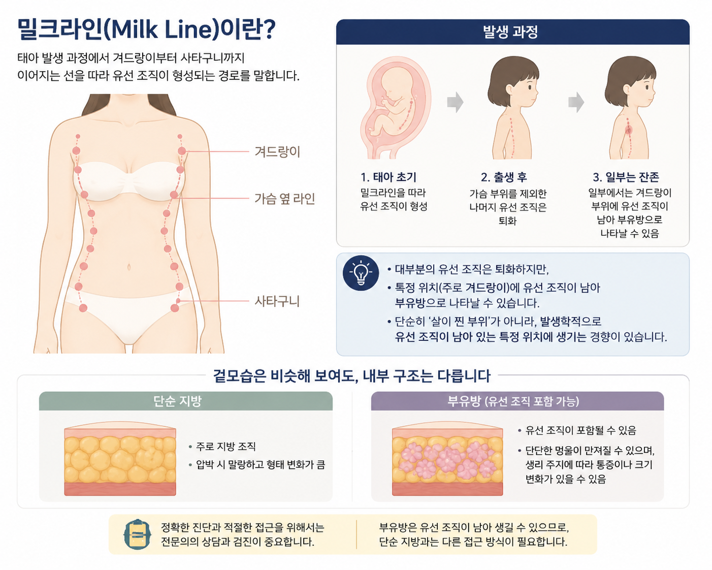 da2e9246-7fbc-495a-9821-c4674069ff2b 부유방과 밀크라인 — 발생 원리부터 수술 접근법까지