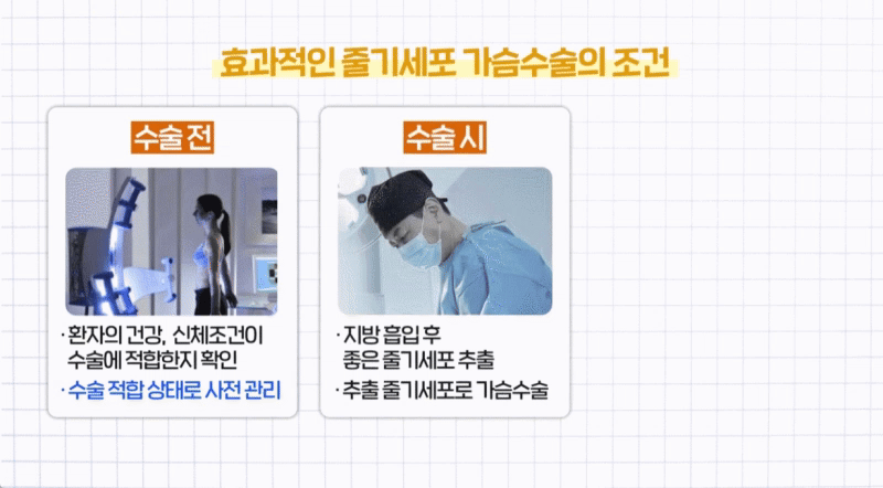 가슴수술조건 자가지방가슴성형 생착률, 병원마다 차이 나는 이유